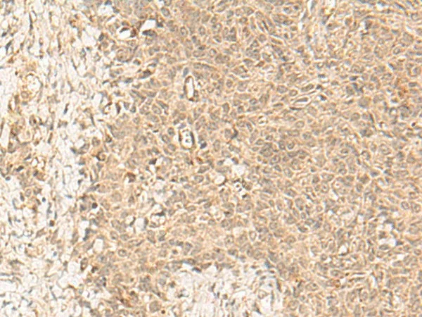 FBXL4 Polyclonal Antibody - image 1