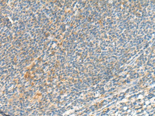 TSHB Polyclonal Antibody - image 1