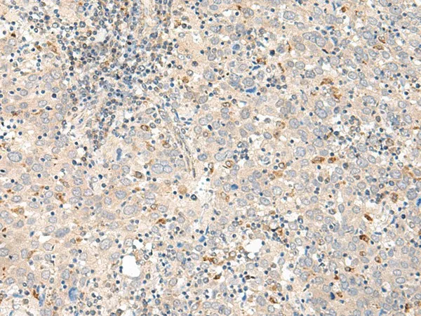 GALR1 Polyclonal Antibody - image 1