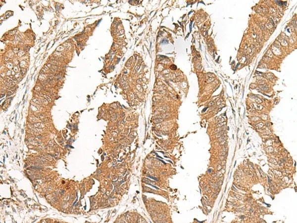 GCC2 Polyclonal Antibody - image 1
