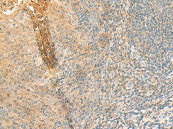 GPT2 Polyclonal Antibody - image 1