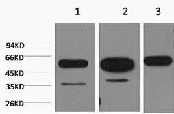 beta Tubulin Monoclonal Antibody - image 1