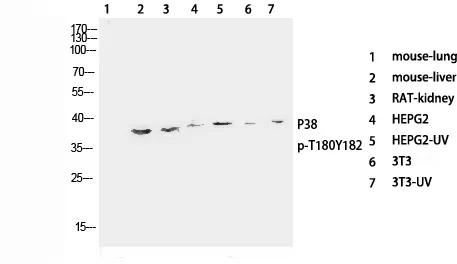 Phospho-P38 (Thr180/Tyr182) Polyclonal Antibody - image 1
