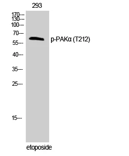 Phospho-PAK1 (Thr212) Polyclonal Antibody - image 1