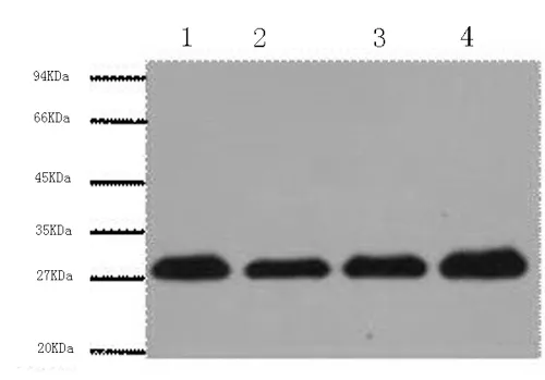 PCNA Monoclonal Antibody - image 1
