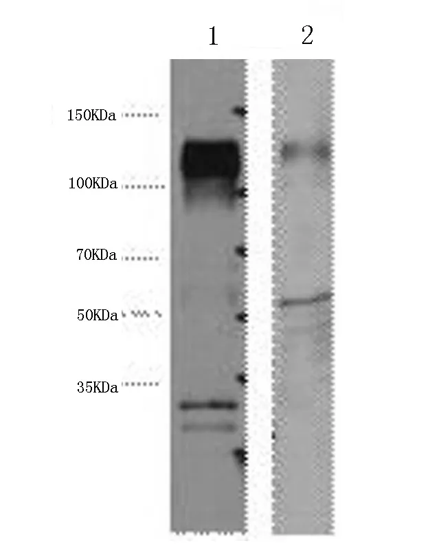 ERBB2 Monoclonal Antibody - image 1