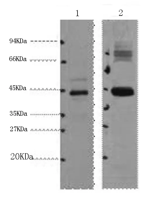 AMACR Monoclonal Antibody - image 1