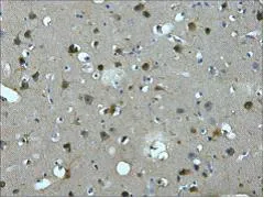 MAP2 Monoclonal Antibody - image 1