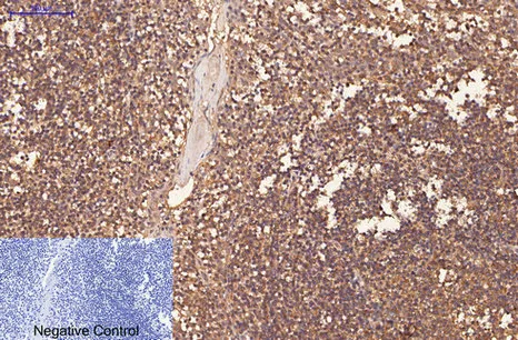 CD1A Monoclonal Antibody - image 1