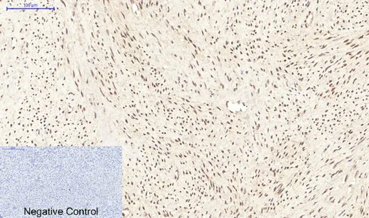 PPARD Monoclonal Antibody - image 1
