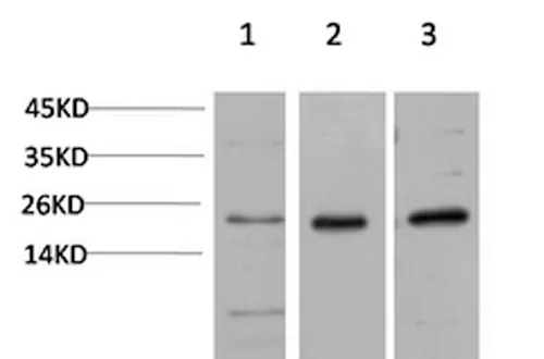 CBX5 Monoclonal Antibody - image 1