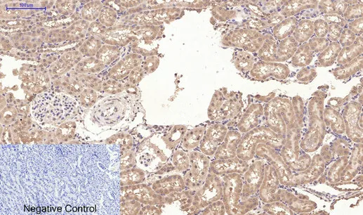 CD10 Monoclonal Antibody - image 1