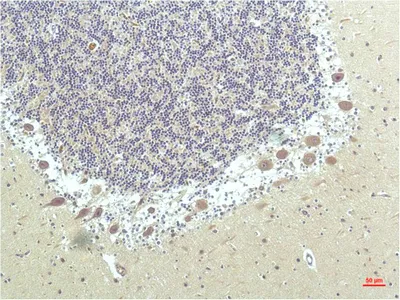PPARD Monoclonal Antibody - image 1