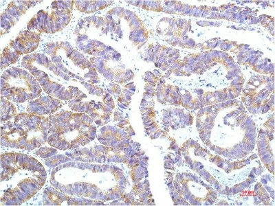 STAT1 Monoclonal Antibody - image 1