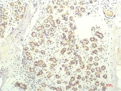 STAT1 Monoclonal Antibody - image 1