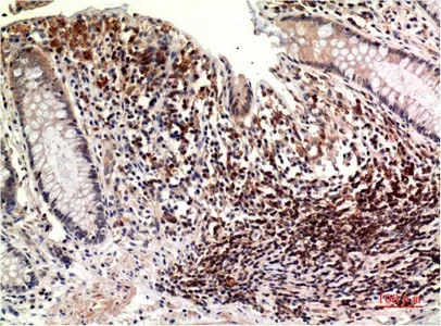 epsilon Tubulin Monoclonal Antibody - image 1