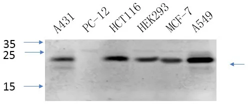 CAV1 Polyclonal Antibody - image 1