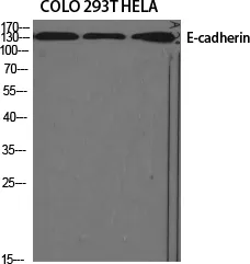 E-Cadherin Polyclonal Antibody - image 1