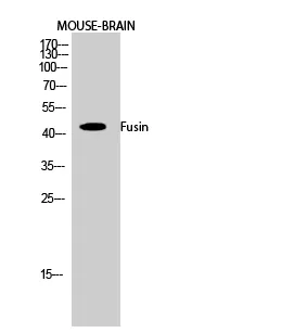 CXCR4 Polyclonal Antibody - image 1