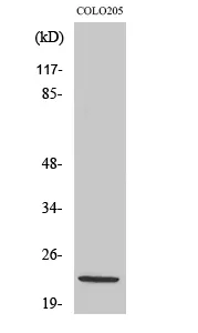 NDUFB10 Polyclonal Antibody - image 1