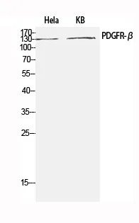 PDGFRB Polyclonal Antibody - image 1