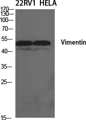 Vimentin Polyclonal Antibody - image 1