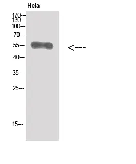 Vimentin Polyclonal Antibody - image 1
