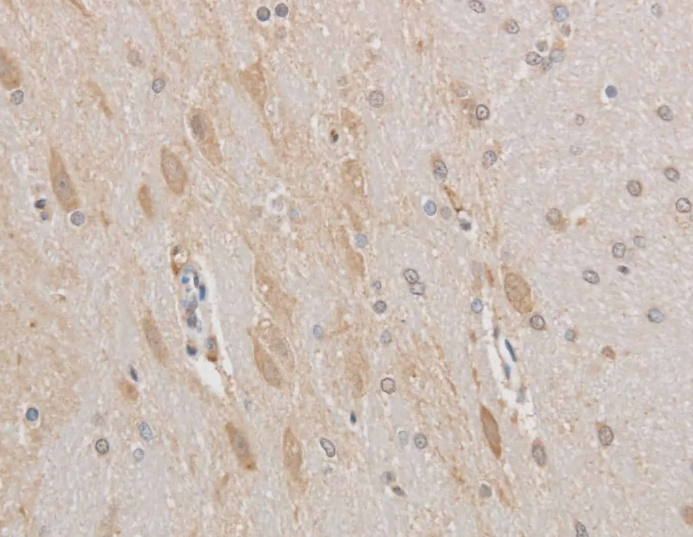 MAP2 Polyclonal Antibody - image 1