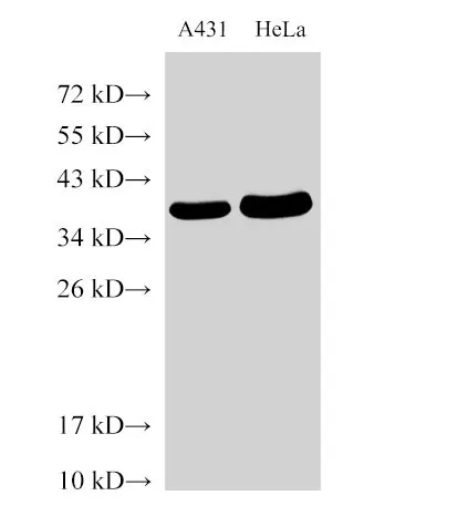 GAPDH Polyclonal Antibody - image 1