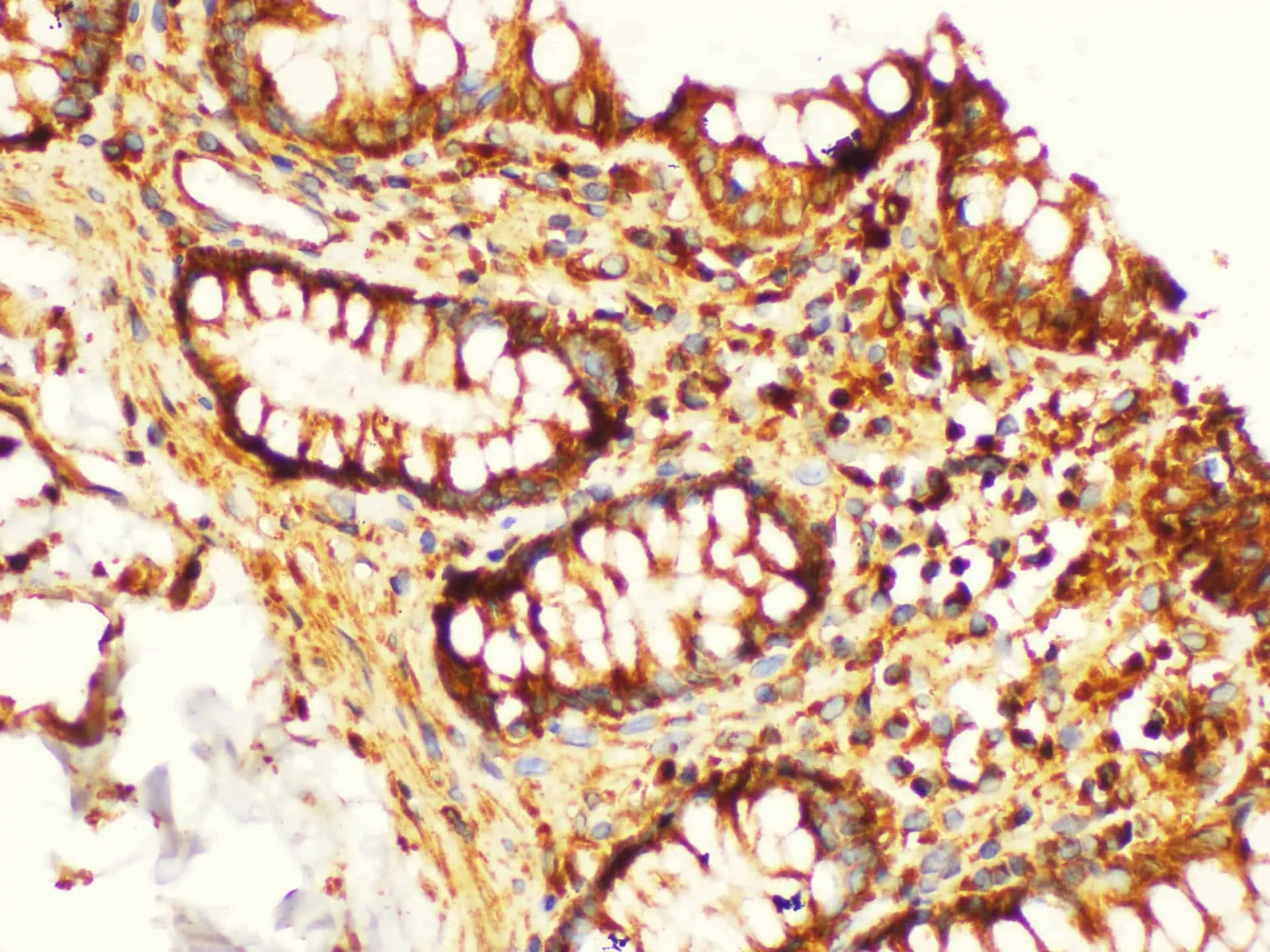 KLK6 Polyclonal Antibody - image 1