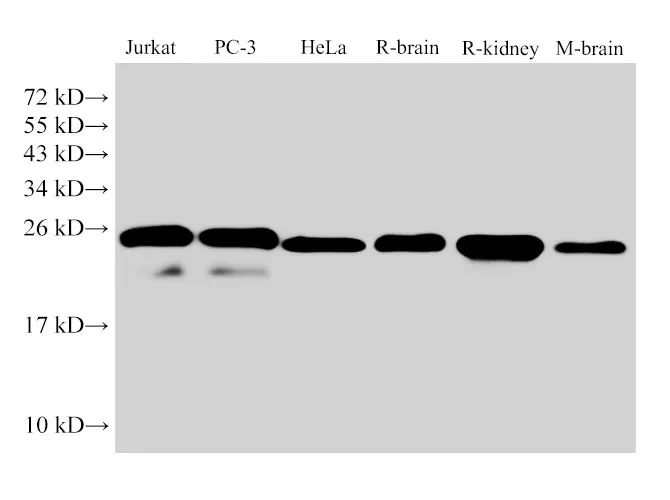 GSTp1 Polyclonal Antibody - image 1