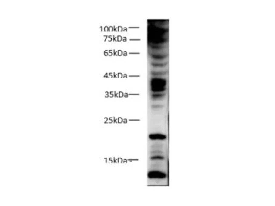 Phosphotyrosine Polyclonal Antibody - image 1