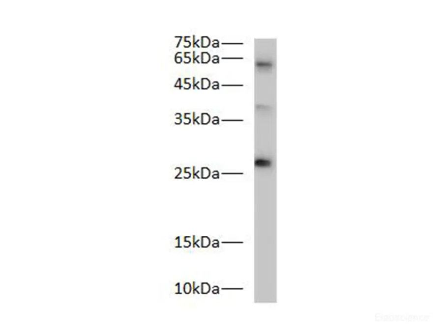 Bcl-2 Polyclonal Antibody - image 1