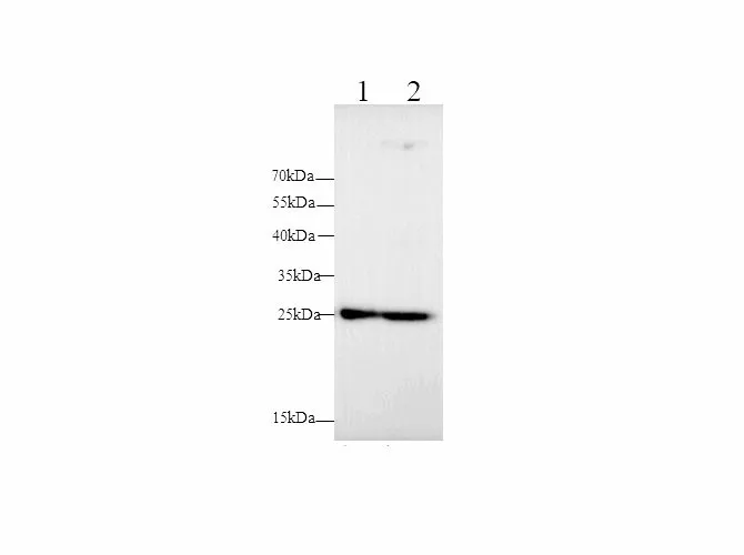 MMP-7 Polyclonal Antibody - image 1