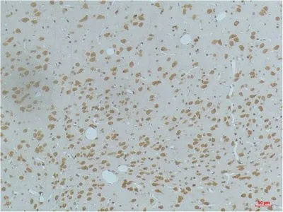 Phospho-CAMK2 beta/gamma/delta (Thr287) Monoclonal Antibody - image 1