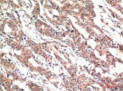 Phospho-STAT3 (Tyr705) Monoclonal Antibody - image 1