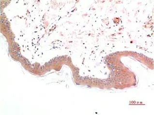 Phospho-SMAD3 (Ser425) Monoclonal Antibody - image 1