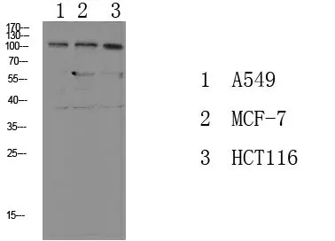 Phospho-Na+/K+-ATPase alpha1 (Tyr260) Polyclonal Antibody - image 1