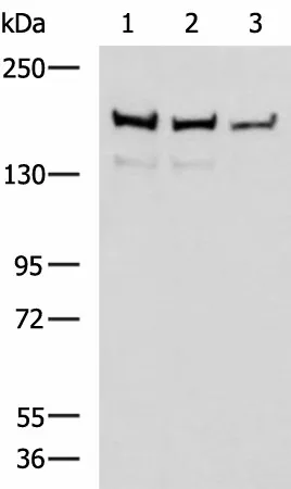 ROCK2 Polyclonal Antibody - image 1