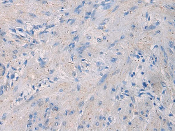 NFKB1 Polyclonal Antibody - image 1