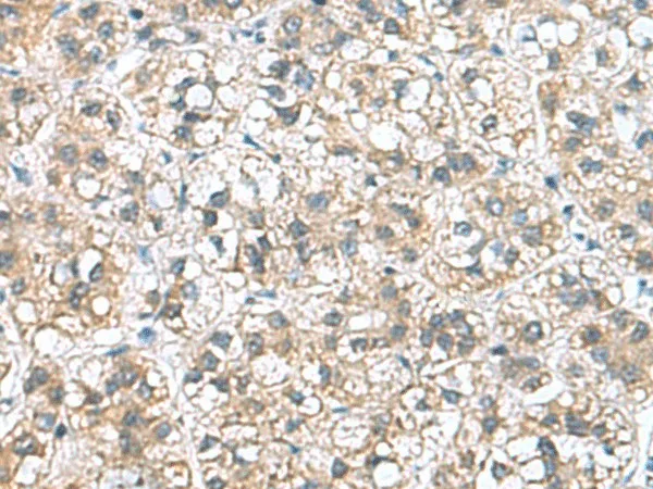 NFKB1 Polyclonal Antibody - image 1