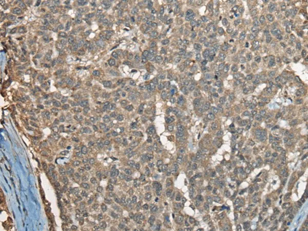 COX7A2L Polyclonal Antibody - image 1