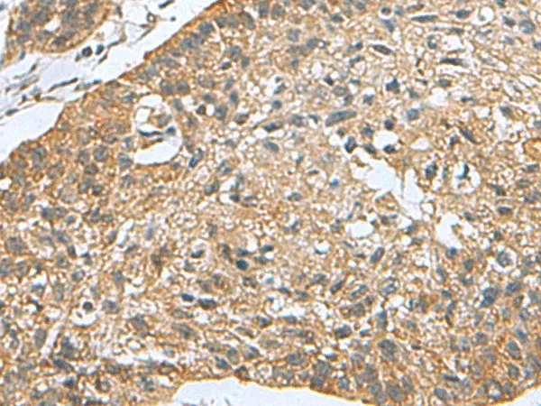 PDCD5 Polyclonal Antibody - image 1