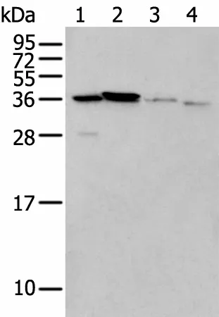 LASP1 Polyclonal Antibody - image 1
