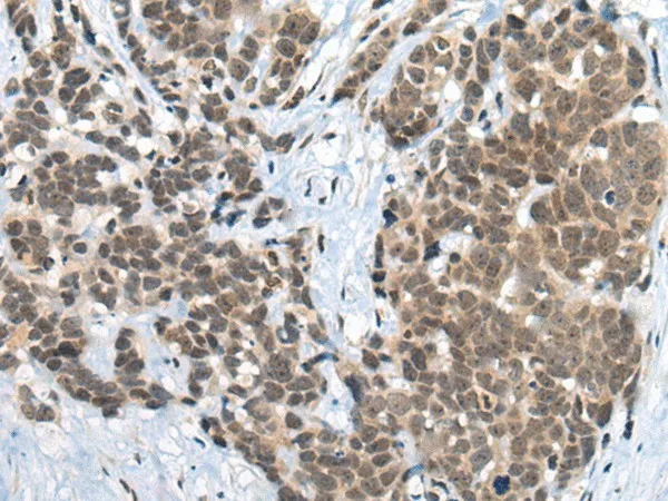 ZNF83 Polyclonal Antibody - image 1