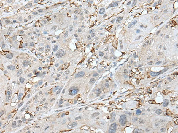 CD14 Polyclonal Antibody - image 1