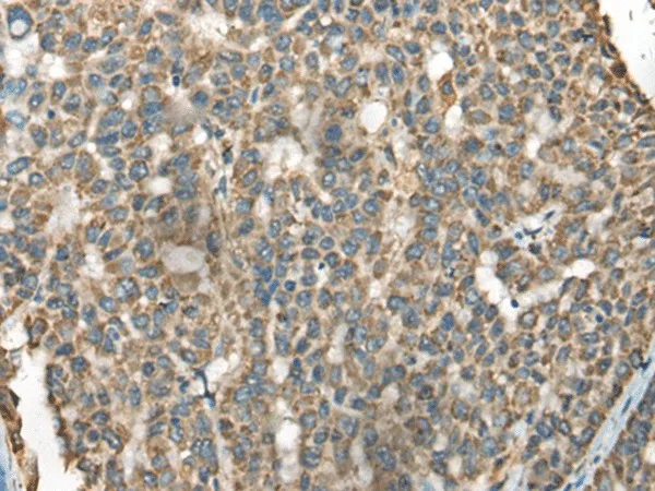 BLNK Polyclonal Antibody - image 1