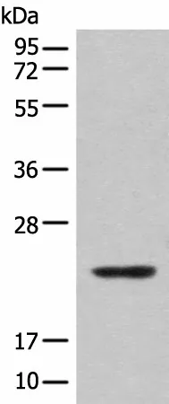 CBFB Polyclonal Antibody - image 1