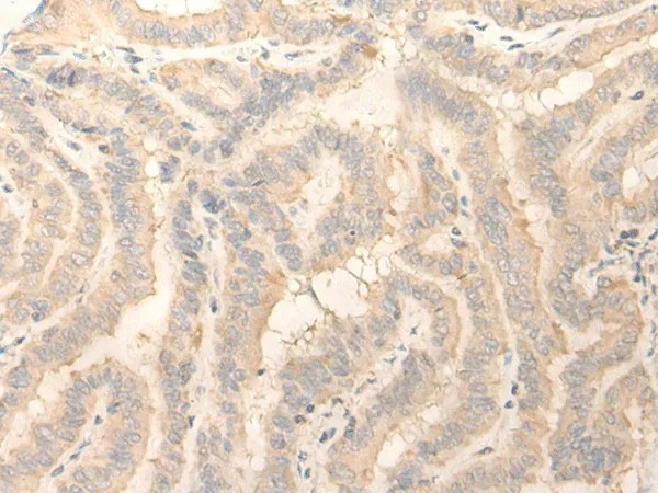ERP27 Polyclonal Antibody - image 1
