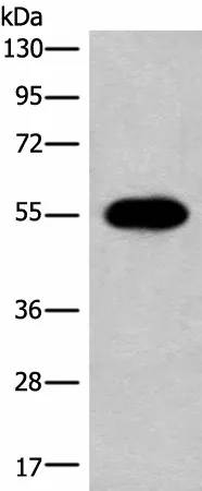 HAS3 Polyclonal Antibody - image 1